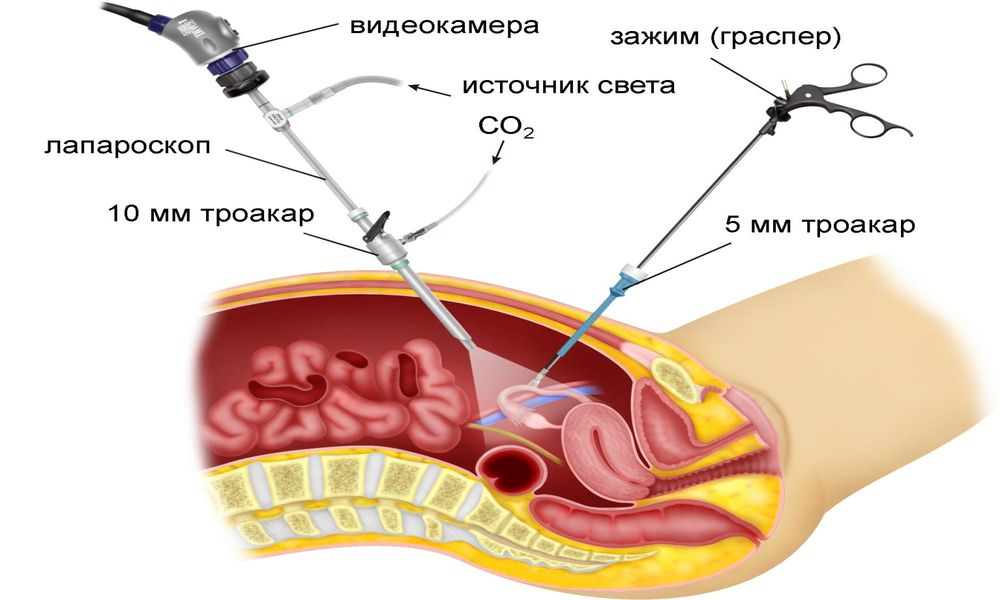 исследование проходимости